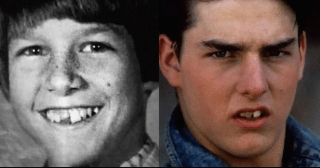 Tom Cruise Teeth Transformation: The Full Story The Real Reason Behind Tom Cruises Midline Shift Middle Tooth Origin And Impact 1024x538