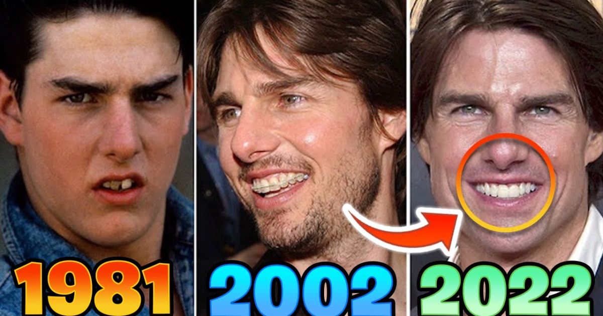 Tom Cruise Teeth Transformation: The Full Story