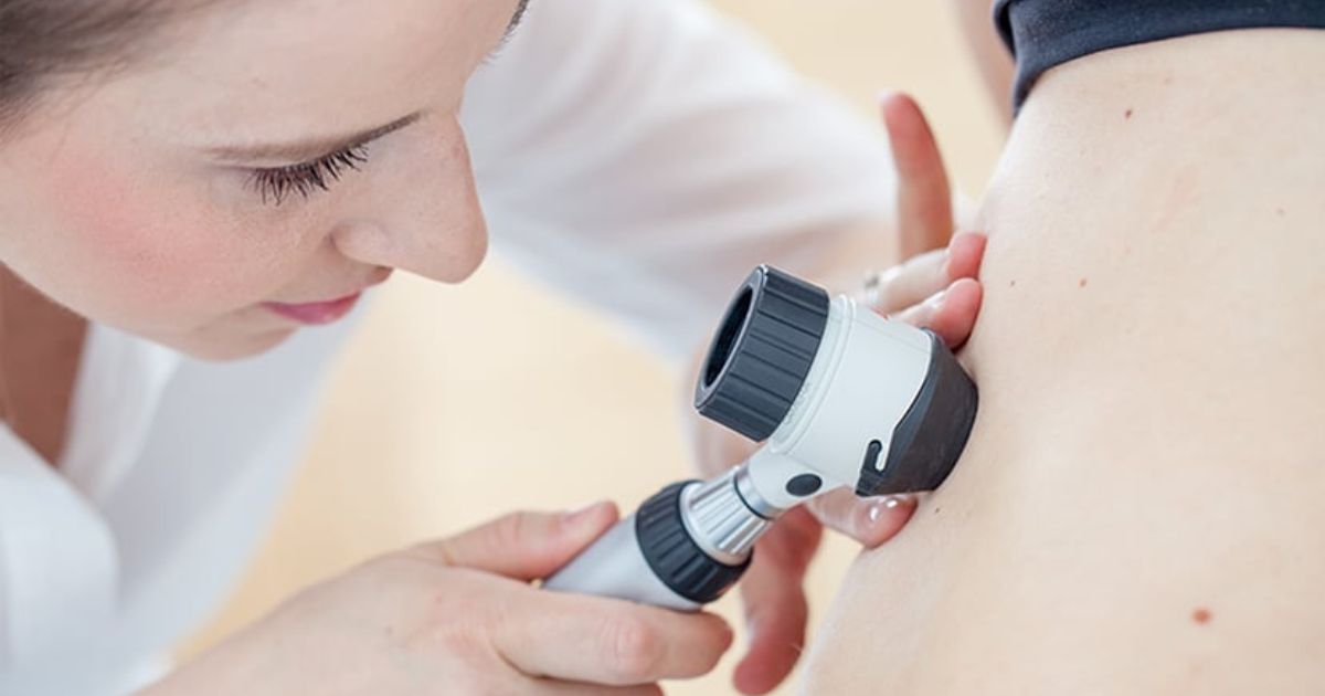 Why Casual Attitudes Toward Sun Exposure Have Quietly Shifted Over the Last Decade