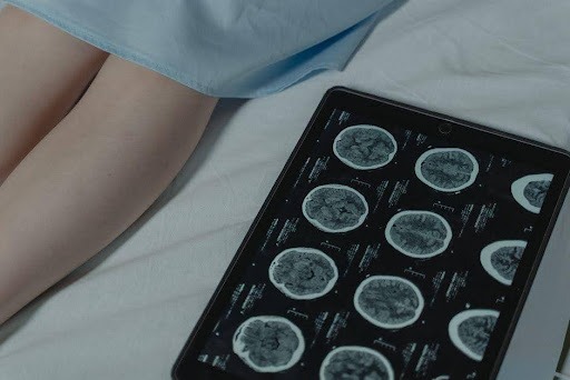 What to Know Before Booking an MRI Appointment